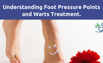 relationship between foot pressure points, medicated shoes, and warts