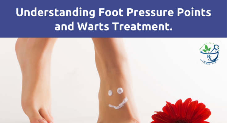 relationship between foot pressure points, medicated shoes, and warts