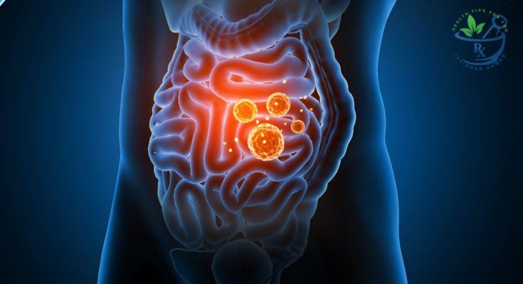 Improve your microbiome for gut health