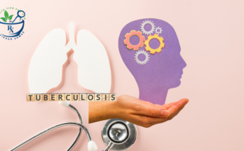 Social Economic Impact of Tuberculosis on Patients